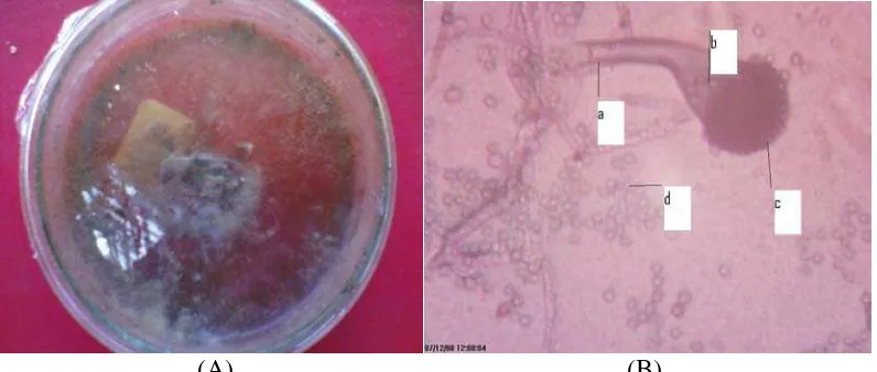 Gambar 7. (A) biakan fungi pada media PDA pada hari ke-14,(B) Aspergillus sp, (a)konidiofor, (b)vesikel, (c)fialid, (d)konidia