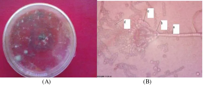 Gambar 9. (A) biakan fungi pada media PDA pada hari ke-14,(B) Penicillium sp, (a)konidiofor, (b)metula, (b)fialid, (d)konidia