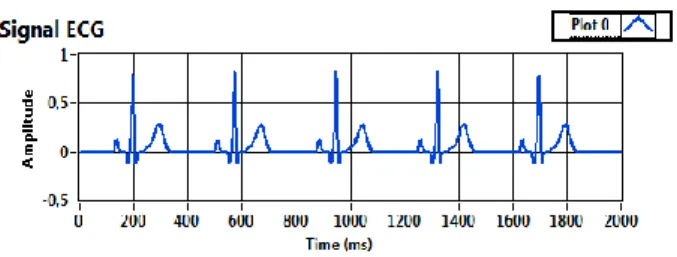 Gambar 4. Sinyal ECG 