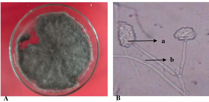 Gambar 4. Ceratocystis sp. Koloni berumur 14 hari pada media PDA (A) dan foto mikroskopik (B), konidia (a), konidiofor (b) 