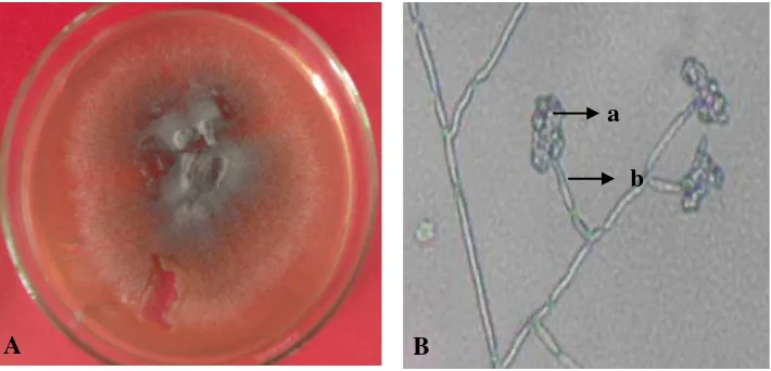 Gambar 5 . Koloni berumur 14 hari pada media PDA (A) dan foto mikroskopik (B), konidia (a), konidiofor (b) 
