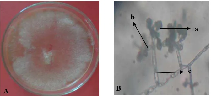 Gambar 6. Trichoderma sp. Koloni berumur 14 hari pada media PDA (A) dan foto mikroskopik (B), konidia (a), fialid (b), konidiofor (c) 