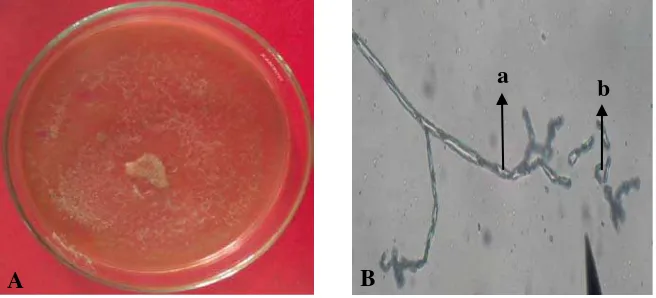 Gambar 8. Geotrichum sp. Koloni berumur 14 hari pada media PDA (A) dan foto mikroskopik (B), konidiofor (a), konidia (b) 