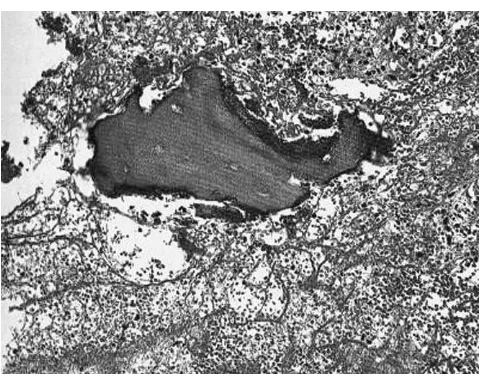 Fig. 4: Photograph taken at surgery.