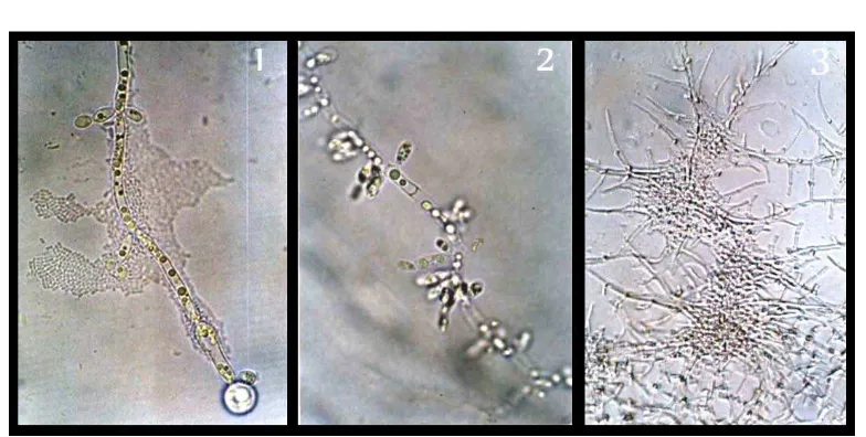 Gambar 6. Candida sp.        tropicalis, secara mikroskopis: 1, Candida albicans, 2, Candida 3, Candida  parapsilosis  
