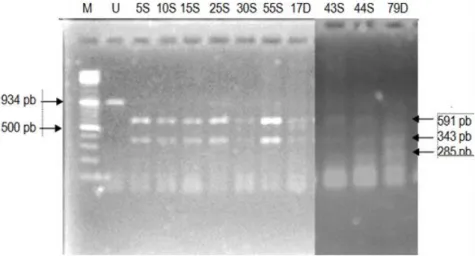 Gambar 1.    Elektroforesis produk PCR-RFLP gen hormon pertumbuhan (GH)                  menggunakan  enzim pemotong Hinf1