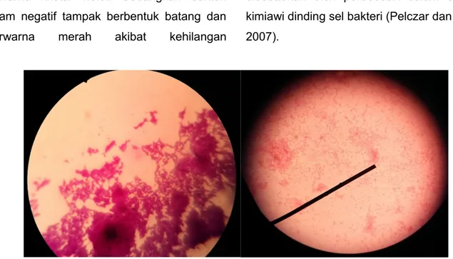 Gambar 2. Pewarnaan Gram Staphylococcus sp. (kiri) danE. coli (kanan)