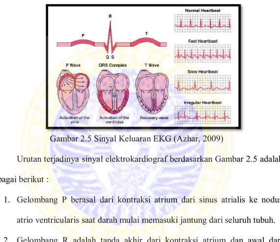 Gambar 2.5 Sinyal Keluaran EKG (Azhar, 2009) 