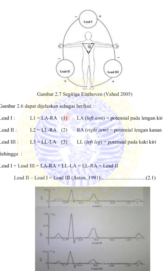 Gambar 2.7 Segitiga Einthoven (Vahed 2005)  Gambar 2.6 dapat dijelaskan sebagai berikut : 