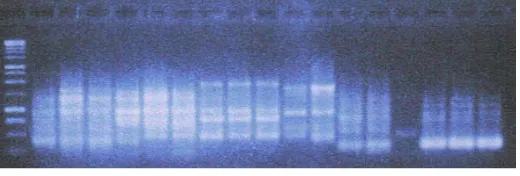 Gambar 1. Profil Pita DNA Hasil Amplifikasi yang Diuji Melalui Gel Agarose 