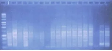 Gambar 6. Profil Pita DNA Hasil Amplifikasi dengan Primer OPD-10 