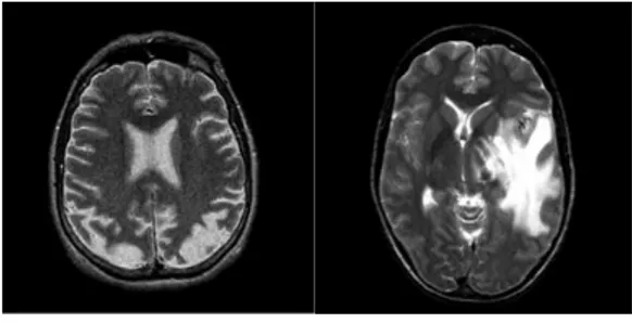Gambar 1. Citra MRI Otak 