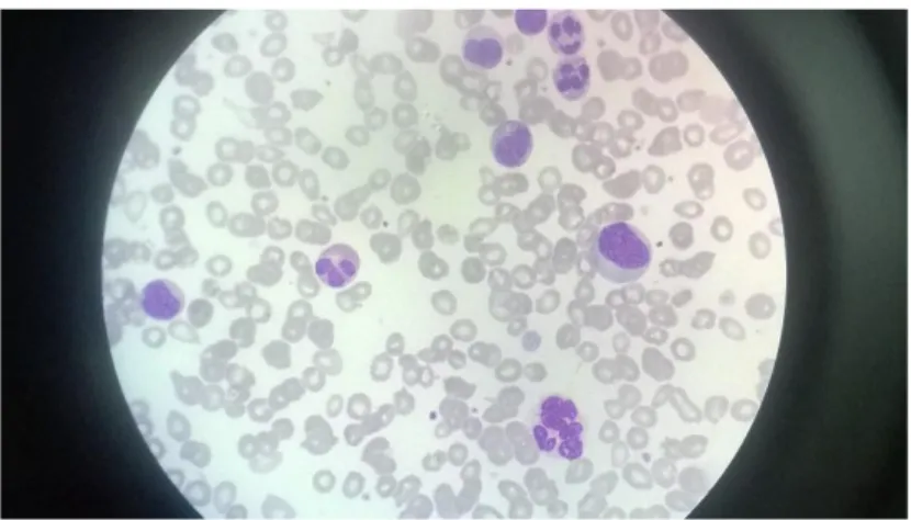 Gambar 2.1 Blood Smear Image dengan Wright staining yang  diamati melalui mikroskop dengan perbesaran 1000x