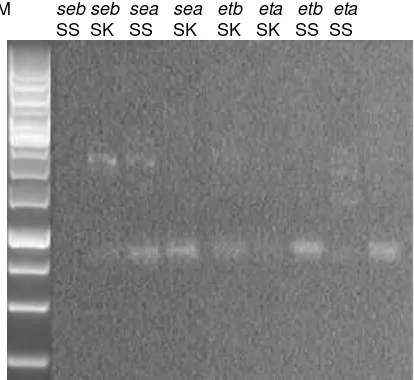 Gambar 3. Hasil elektroforesis gen enterotoksin (sea, seb) dan exfoliatif (eta, etb).   M= Marker, SS= susu sapi, SK= susu kambing  