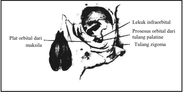 Gambar 6 :  Dinding lateral orbital (Robert H. Mathog, M.D, Maxillofacial trauma,Williams & Wilkins, 1984:322) 
