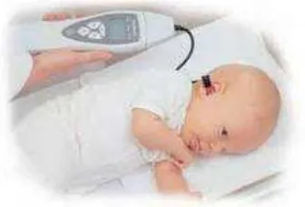 Gambar 2.6. Emisi otoakustik pada bayi baru lahir (Norton and Stoner, 1994) 