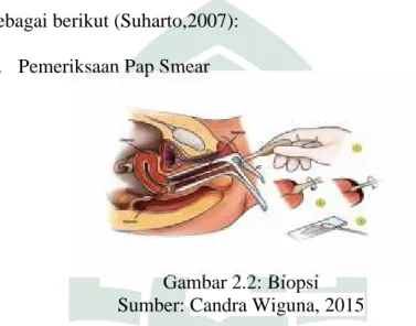 Gambar 2.2: Biopsi Sumber: Candra Wiguna, 2015