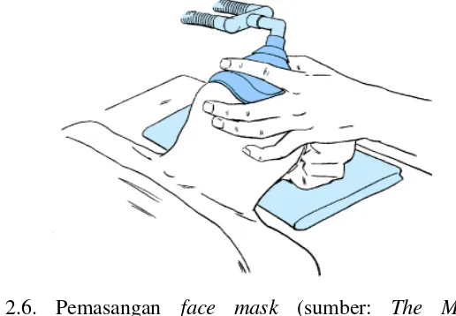 Gambar 2.6. Pemasangan face mask (sumber: The McGraw-Hill 