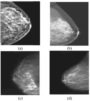 Gambar 4 Data citra mammogram 