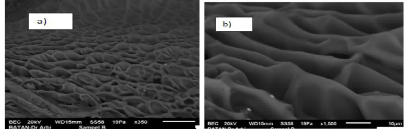 Figure 8. The scanning micrograph of the surface of  NaAlg-g- (potassium acrylate) hydrogels prepared by using irradiation were taken with a magnification ; a) 350x and b) 1500x (the scale bar are 50 µm and 10 µm)