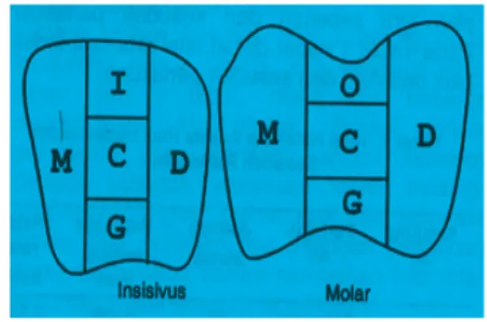 Gambar 1 Subdivisi pada Bidang Labial/Bukal dan      Lingual Gigi Indeks. M=mesial, I=incial, 