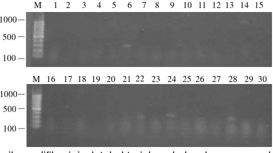 Gambar 5. Hasil amplifikasi isolat bakteri busuk lunak menggunakan primer Burk3/BurkR pada reaksi PCR yang dielektroforesis pada 1% gel agarosa