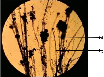 Gambar 2. Penampakan Aspergillus sp. Dibawah mikroskop (perbesaran 10 kali) 
