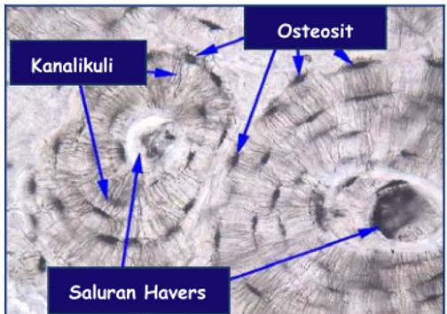 Gambar 2  Osteon yang merupakan unit struktural primer tulang. Terdiri atas  lamel-lamel konsentris dan saluran Havers (IOF 2009)