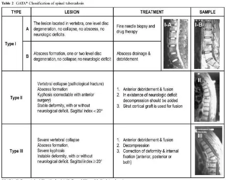 Tabel 6. Klasifikasi Spondilitis Tuberkulosa Dikutip dari : Oguz E, Sehirlioglu A, Altinmakas M,et al