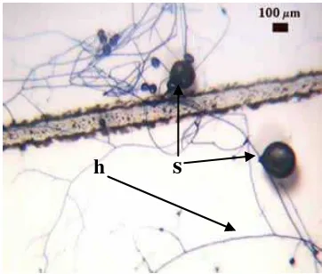 Gambar 5 : Gambar mikroskopis CMA dalam jaringan akar dengan  