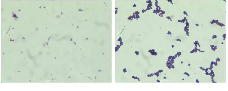 Gambar 4. A. Bentuk koloni isolat Corynebacterium aquaticum B. Bentuk koloni                  isolat Micrococcus luteus (pembesaran 100x) 