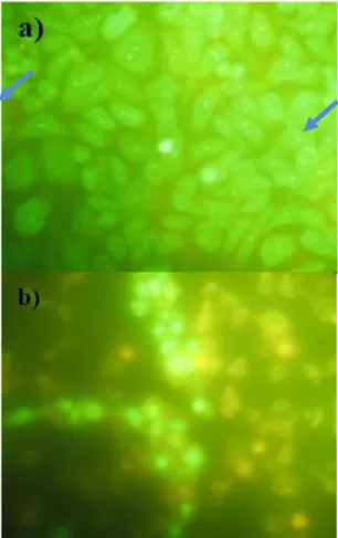 Gambar 4.3 Hasil uji double staining fraksi etil asetat daun benalu Nangka  menggunakan acridine orange