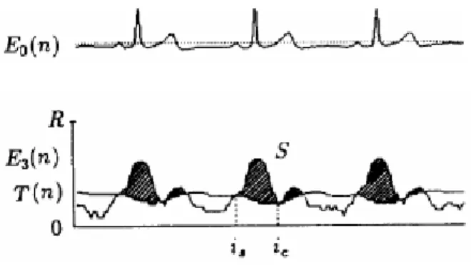 Gambar 2.31 Periode Deteksi QRS 