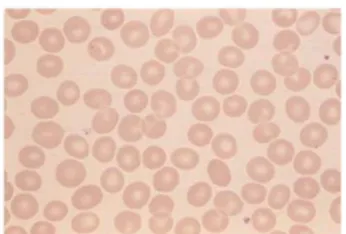 Gambar 1. Sel darah merah normal [11]  
