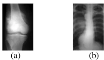 Gambar 4.1   Contoh hasil pembacaan citra yang          ditampilkan dalam  aras keabuan  (a)  Tumor di jaringan sekitar tulang  (b)  Tumor  paru-paru 