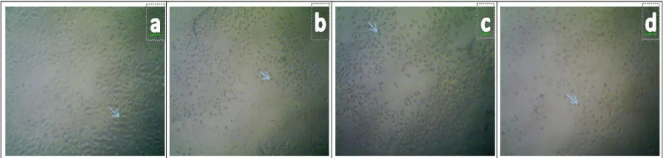 Gambar 4. Morfologi sel T47D pada kontrol sel (a), kontrol pelarut DMSO 1,56%  (b), kematian sel  akibat perlakuan ekstrak 800 µl/mL (c), perlakuan dengan Doksorubisin (d), dan tanda panah 
