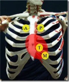 Gambar 5. Pemeriksaan bising jantung di lokasi katub jantung