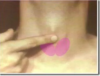 Gambar 6. Pemeriksaan kelenjar tiroid
