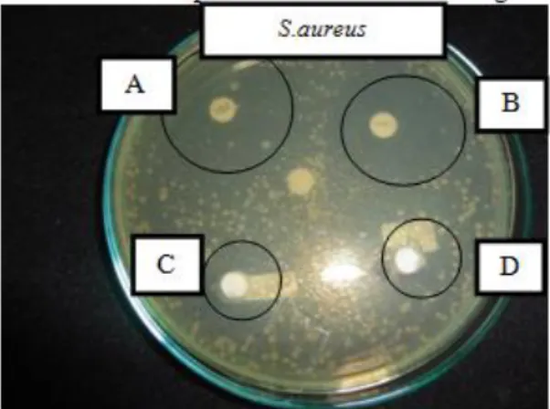 Gambar  4.  Uji  Sensitivitas  Staphylococcus  aureus  terhadap  Antibiotic  Keterangan : 