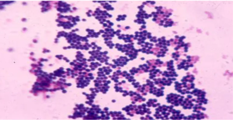 Gambar bakteri Staphylococcus aureus dapat dilihat pada gambar 2.1 dibawah ini: 