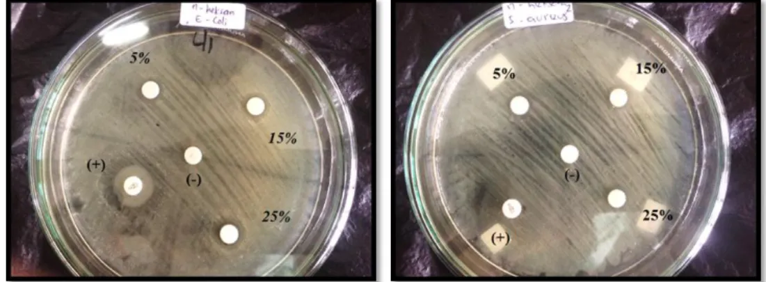 Gambar 4.2 Zona hambat bakteri dengan ekstrak n-heksana  pada: (a) E.coli ,(b) S.aureus 