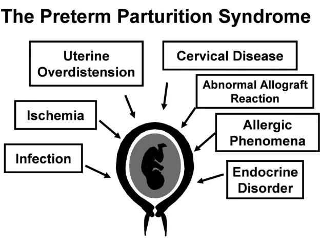 Figure 1 Pathological processes implicated in thepreterm parturition syndrome. (Reproduced withpermission from Romero and coworkers.24)