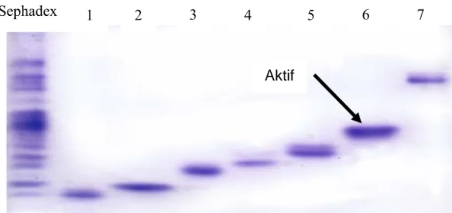 Gambar 3. Visualisasi protein hasil pemisahan dengan Native-PAGE. 