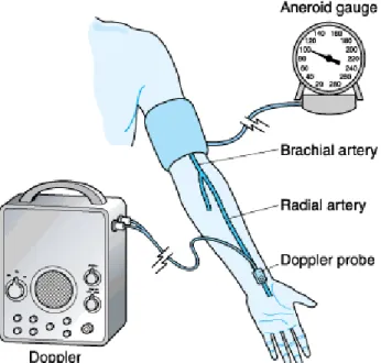 Gambar 1. Probe Doppler harus selalu tepat di atas arteri agar pengukuran tekanan darah akurat.