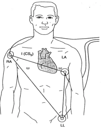 Gambar 5. Konfigurasi penempatan 3 lead EKG pada pasien.