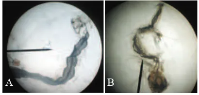 Gambar 1. Sifon pada larva nyamuk (tanda panah): A: Aedes aegypti; B: Culex spp.