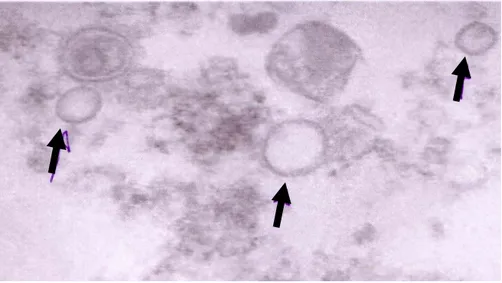 Gambar 3. Morfologi Orthomyxovirus yang diperoleh dari isolat virus yang berasal dari sampel proventrikulus grup A  Tabel 6