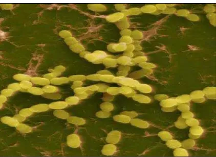 Gambar 2.3.1. Streptococcus thermophilus (Kunkel, 2008) 