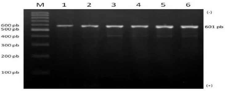 Gambar 3 Hasil amplifikasi gen POU1F1 pada gel agaose 1,5%