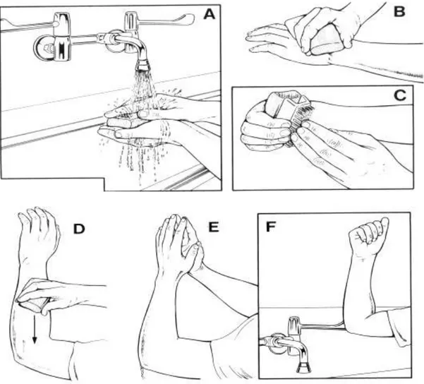 Gambar 3. Langkah mencuci tangan secara aseptik Fuerbringer 